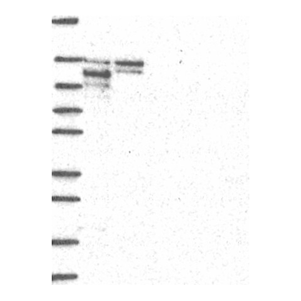 Atlas Antibodies Anti-ZMIZ1 Antibody