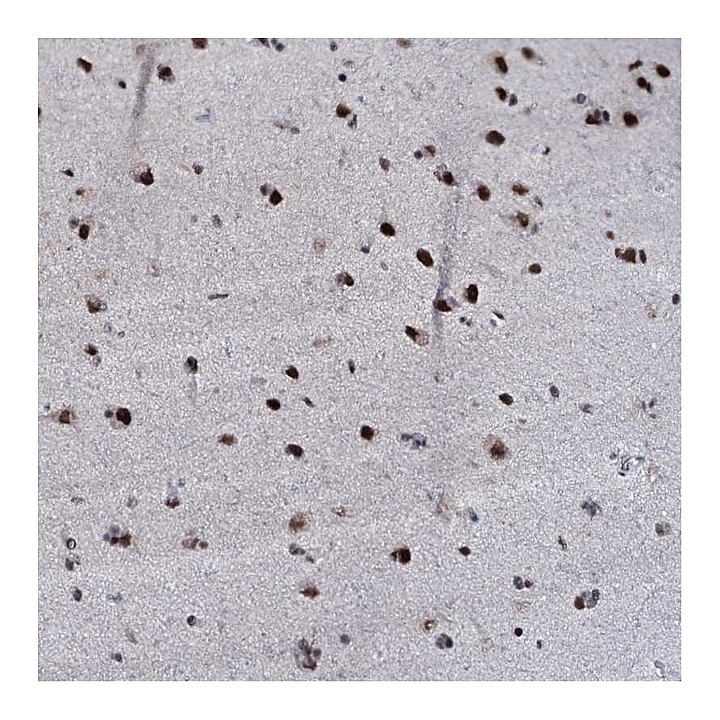 Atlas Antibodies Anti-ZMIZ2 Antibody
