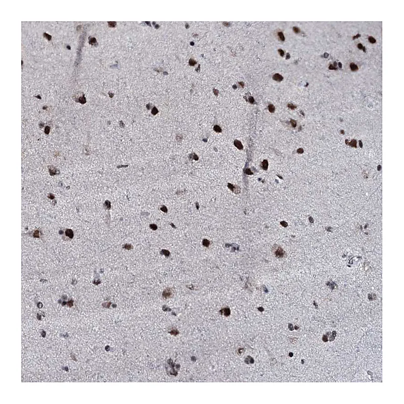 Atlas Antibodies Anti-ZMIZ2 Antibody