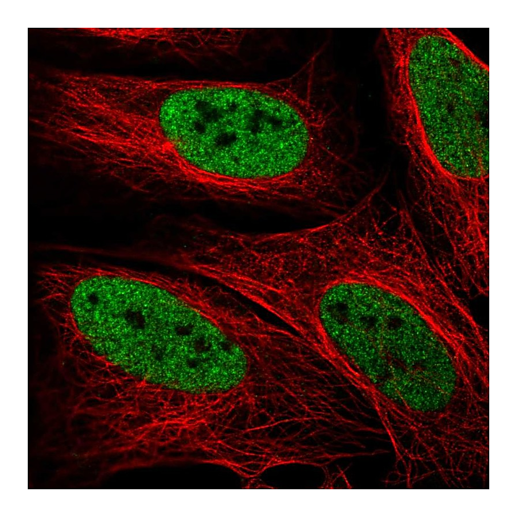 Atlas Antibodies Anti-ZMYM3 Antibody