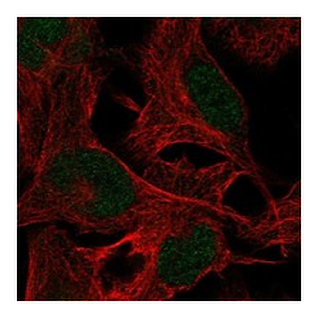 Atlas Antibodies Anti-ZMYM5 Antibody