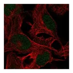 Atlas Antibodies Anti-ZMYM5 Antibody