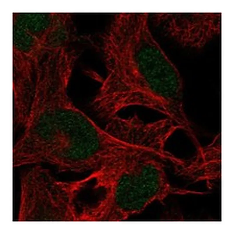 Atlas Antibodies Anti-ZMYM5 Antibody