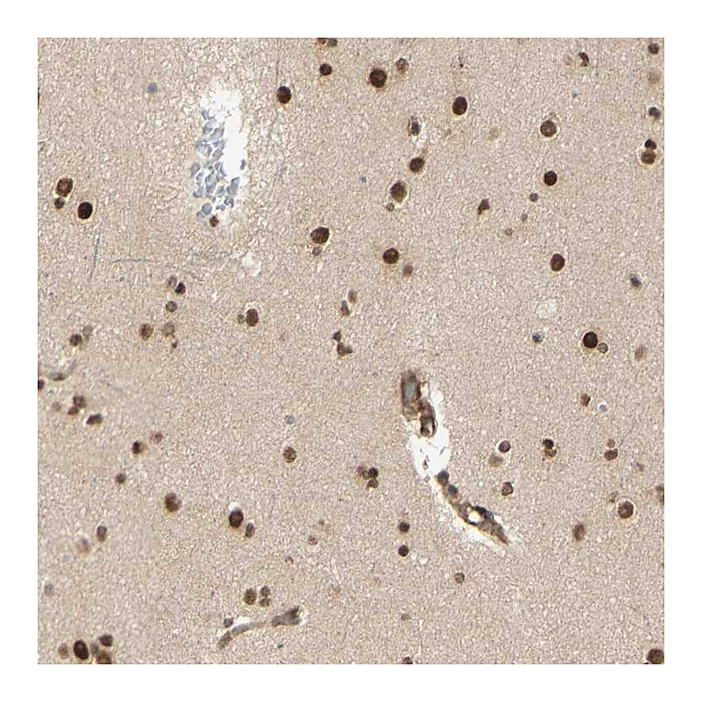 Atlas Antibodies Anti-ZMYM6 Antibody