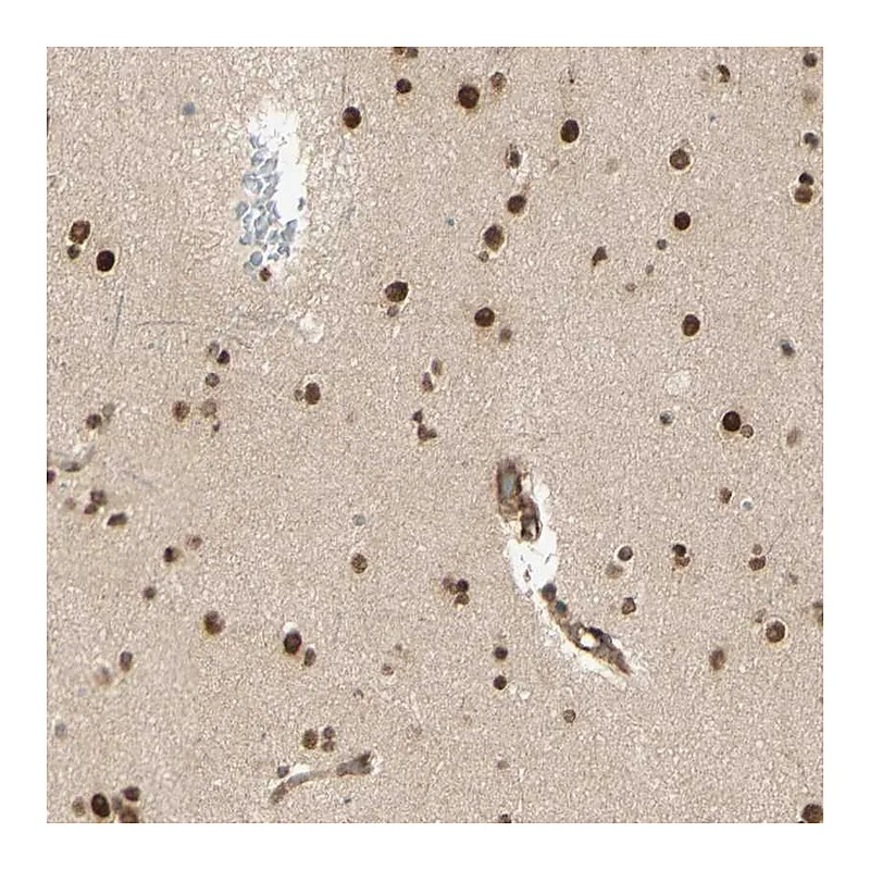 Atlas Antibodies Anti-ZMYM6 Antibody
