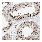 Atlas Antibodies Anti-ZMYM2 Antibody
