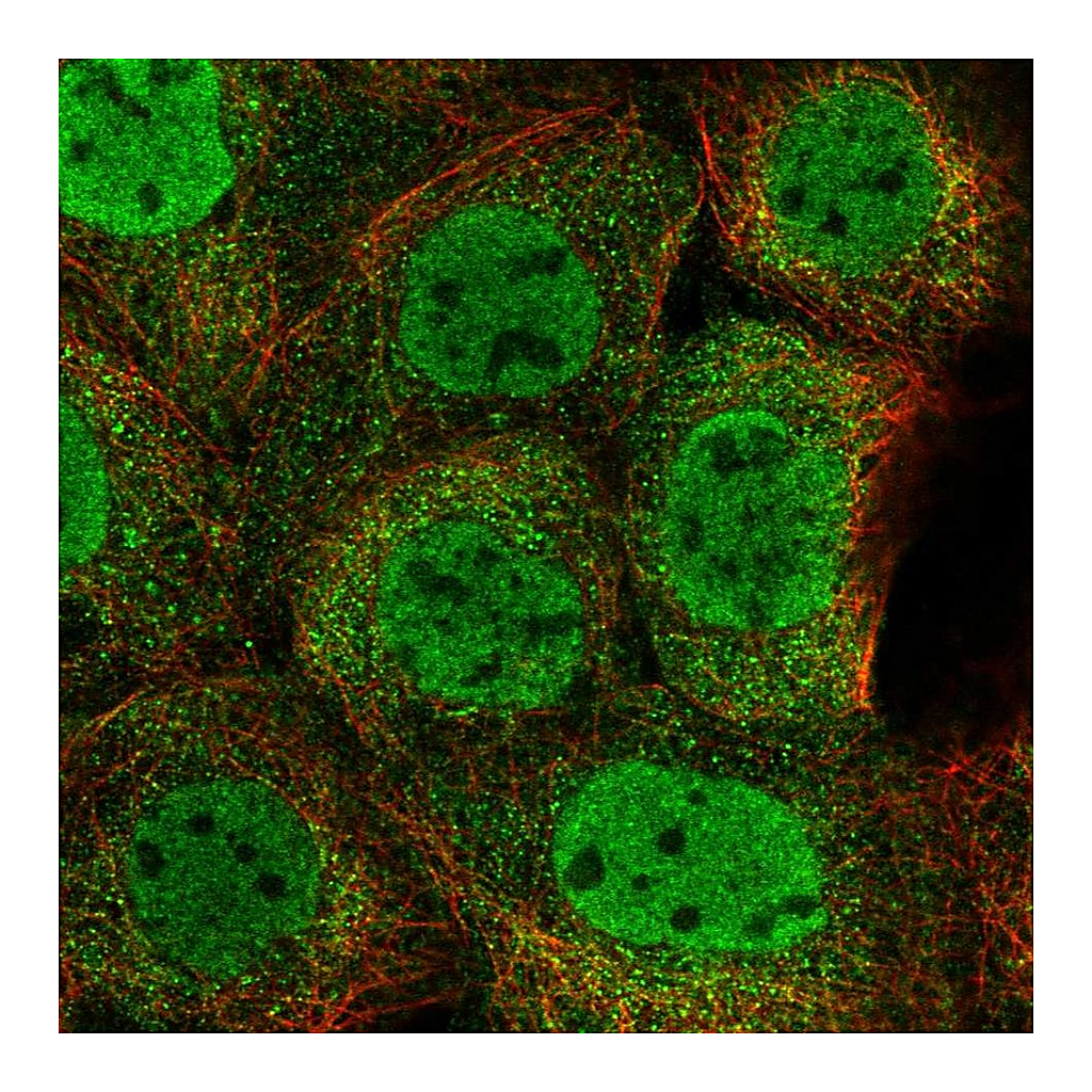 Atlas Antibodies Anti-ZMYM4 Antibody