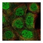 Atlas Antibodies Anti-ZMYM4 Antibody