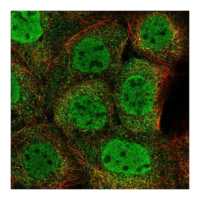 Atlas Antibodies Anti-ZMYM4 Antibody
