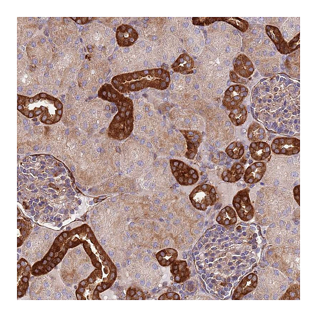 Atlas Antibodies Anti-ZMYM5 Antibody