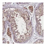 Atlas Antibodies Anti-ZMYM4 Antibody