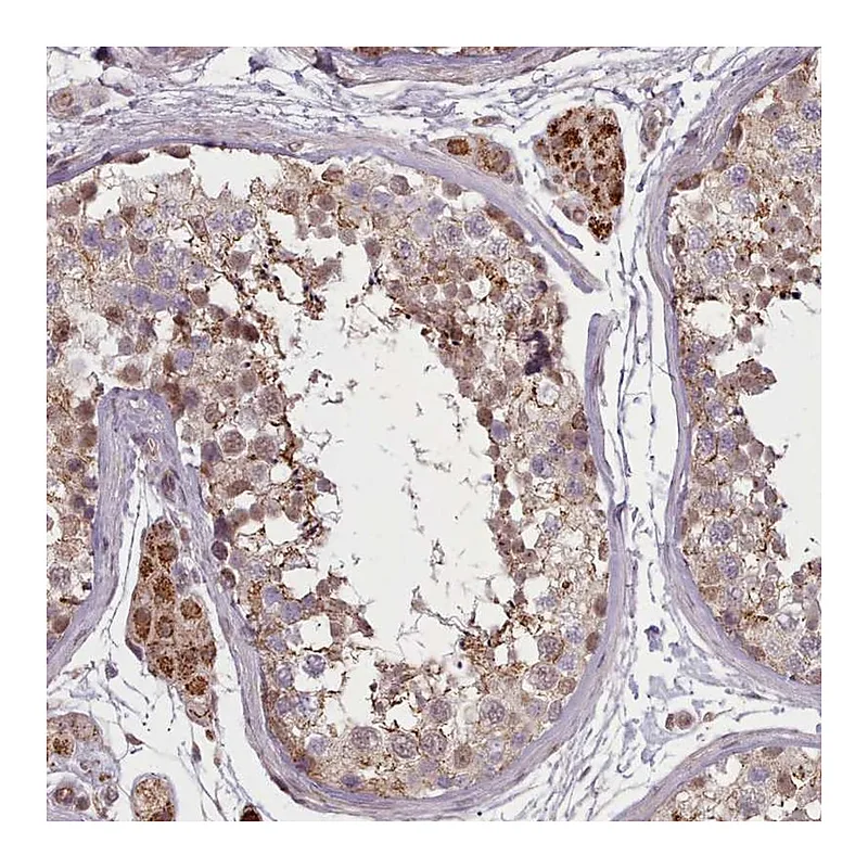Atlas Antibodies Anti-ZMYM4 Antibody