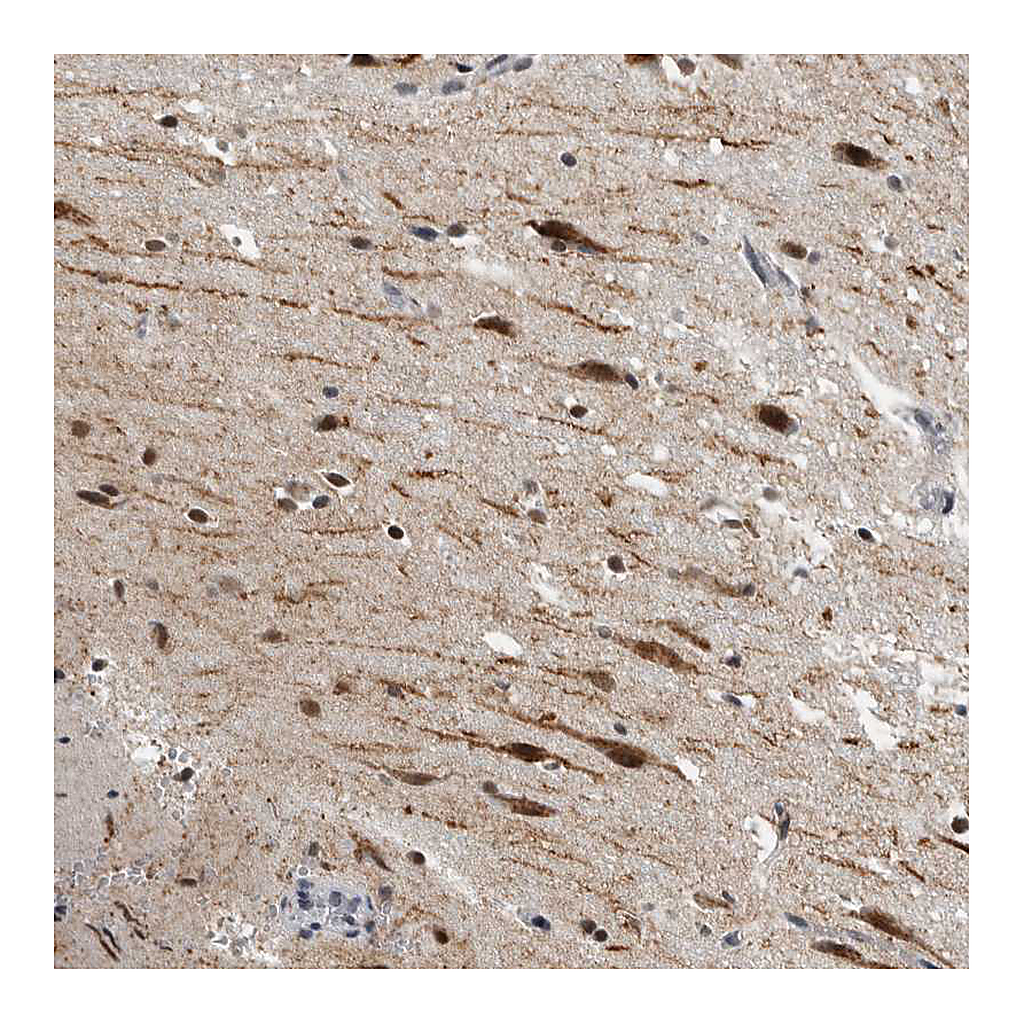 Atlas Antibodies Anti-ZMYND8 Antibody