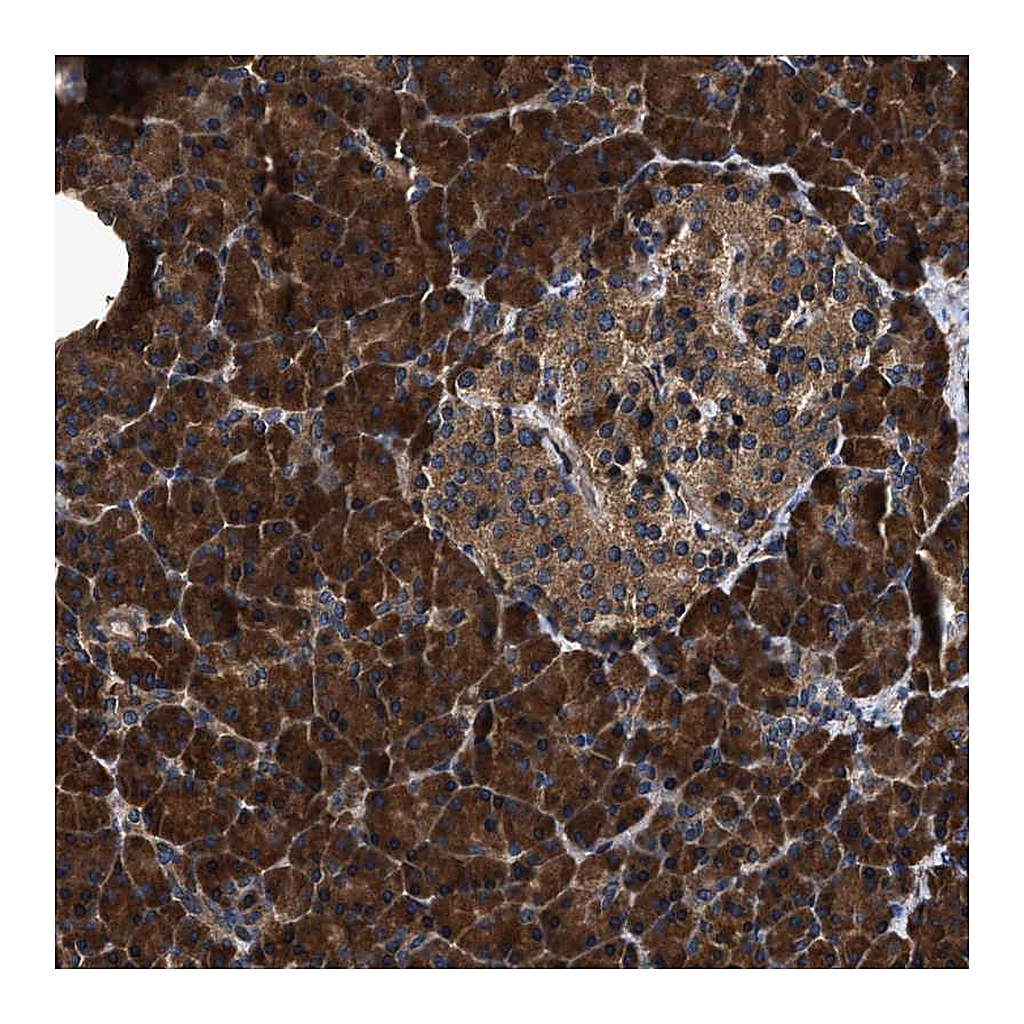 Atlas Antibodies Anti-ZMYND19 Antibody