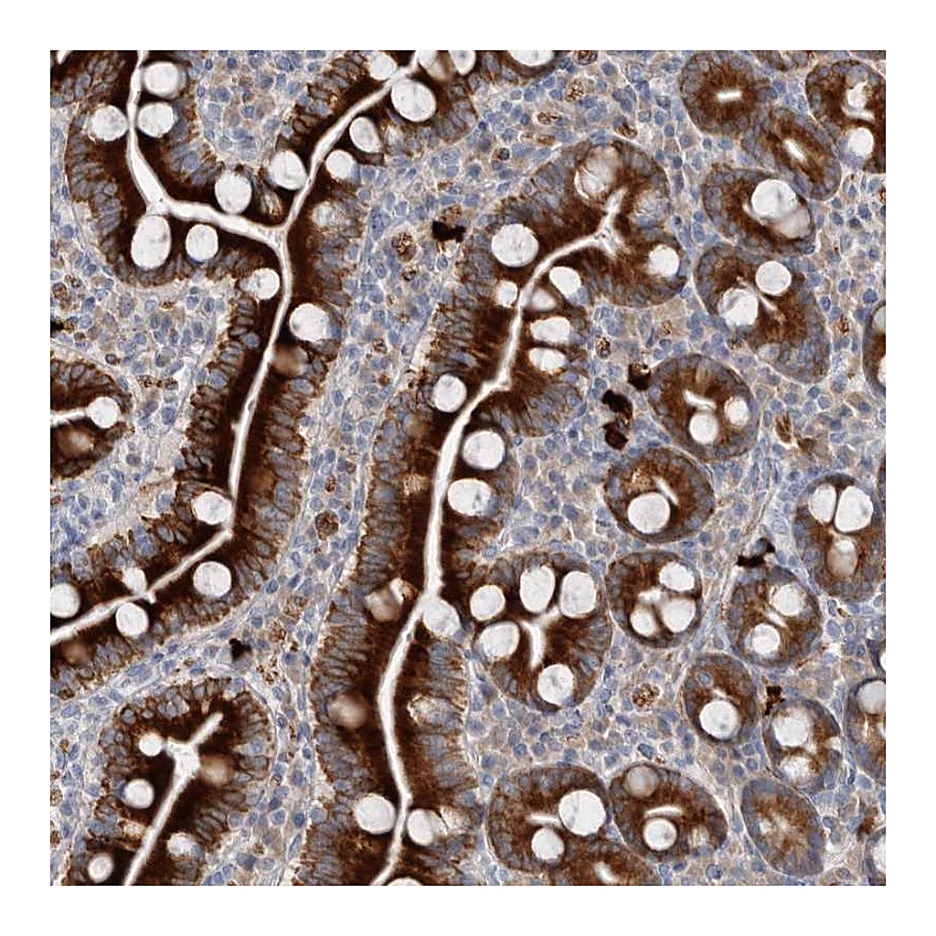 Atlas Antibodies Anti-ZNF114 Antibody