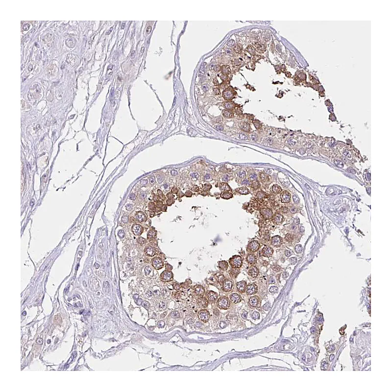 Atlas Antibodies Anti-ZNF101 Antibody