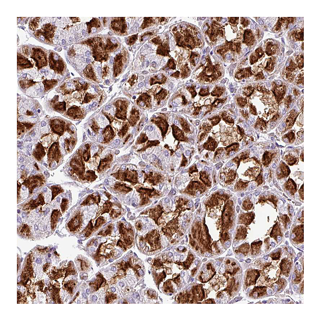 Atlas Antibodies Anti-ZNF106 Antibody