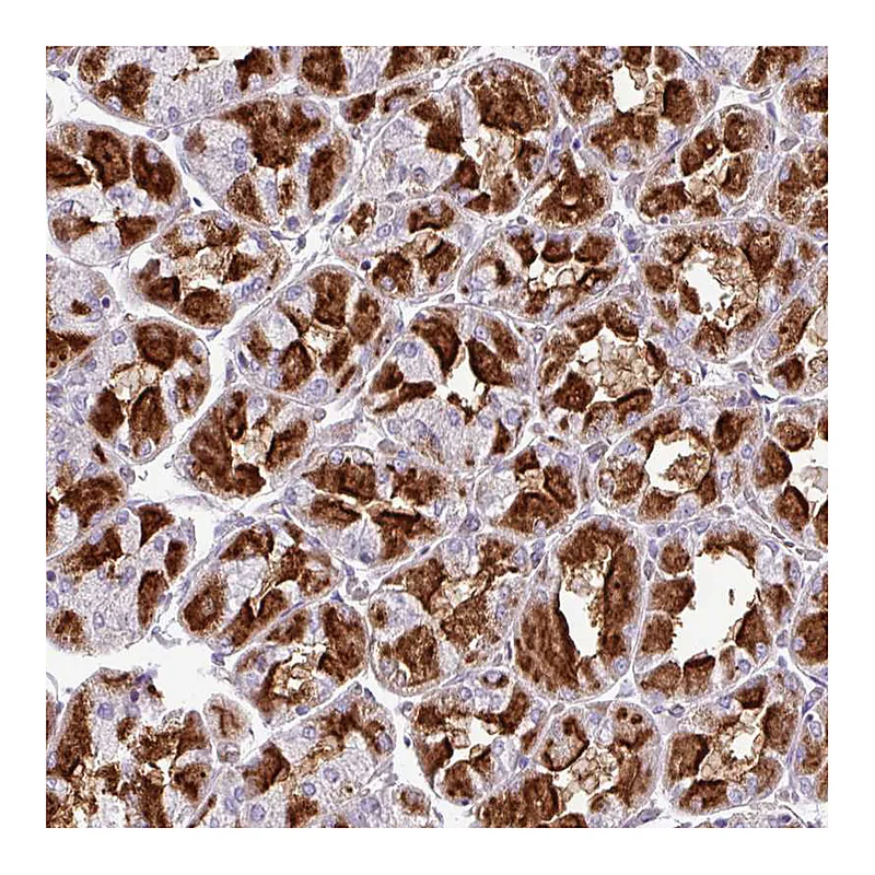 Atlas Antibodies Anti-ZNF106 Antibody
