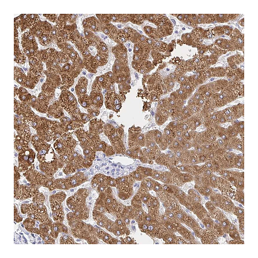 Atlas Antibodies Anti-ZNF100 Antibody