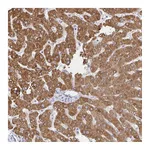 Atlas Antibodies Anti-ZNF100 Antibody
