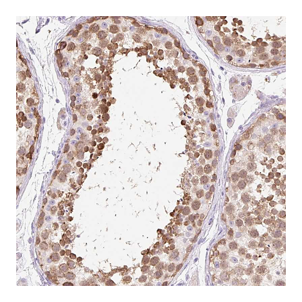Atlas Antibodies Anti-ZNF121 Antibody