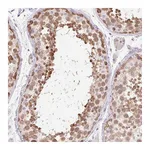 Atlas Antibodies Anti-ZNF121 Antibody