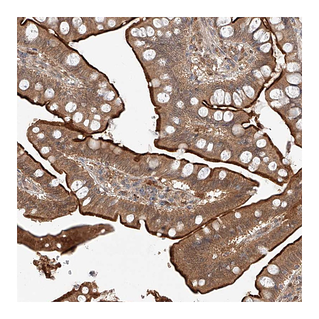 Atlas Antibodies Anti-ZNF124 Antibody
