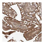 Atlas Antibodies Anti-ZNF124 Antibody