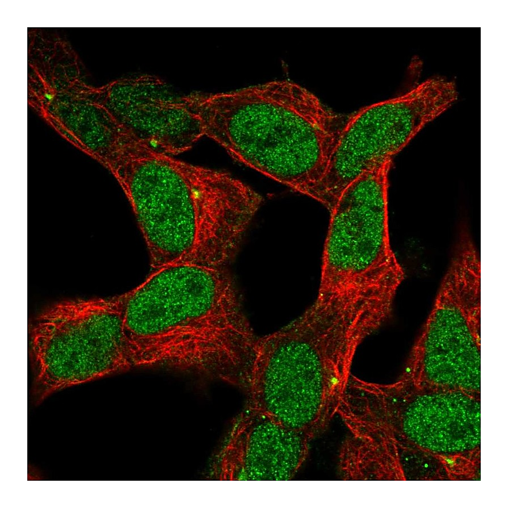 Atlas Antibodies Anti-ZNF12 Antibody
