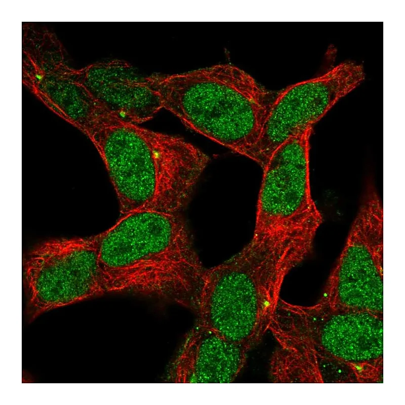 Atlas Antibodies Anti-ZNF12 Antibody