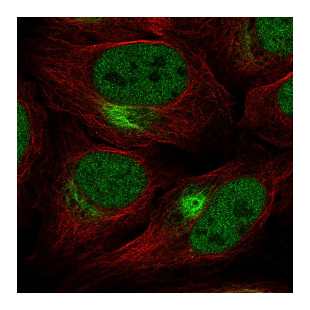 Atlas Antibodies Anti-ZNF131 Antibody