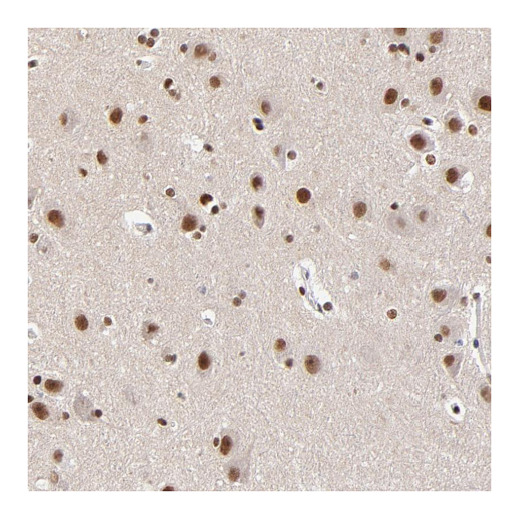 Atlas Antibodies Anti-ZMYM3 Antibody