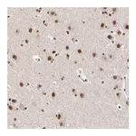 Atlas Antibodies Anti-ZMYM3 Antibody