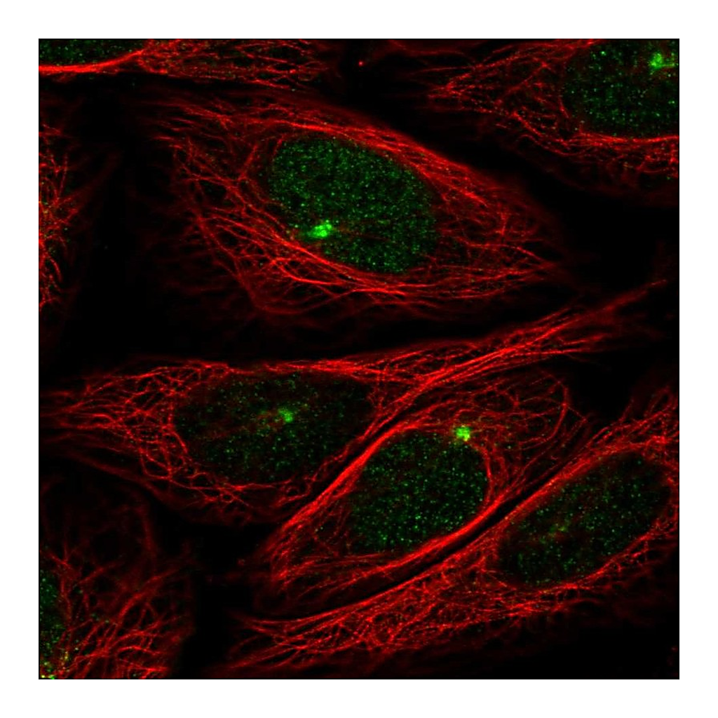 Atlas Antibodies Anti-ZMYM1 Antibody