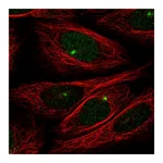 Atlas Antibodies Anti-ZMYM1 Antibody