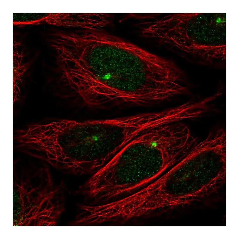 Atlas Antibodies Anti-ZMYM1 Antibody