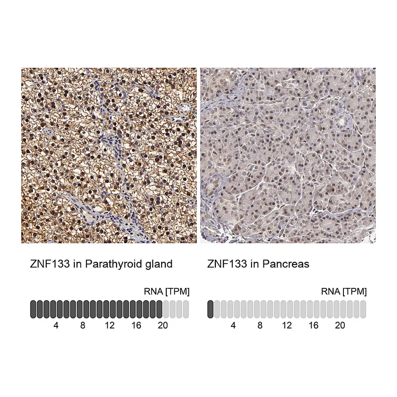 Atlas Antibodies Anti-ZNF133 Antibody