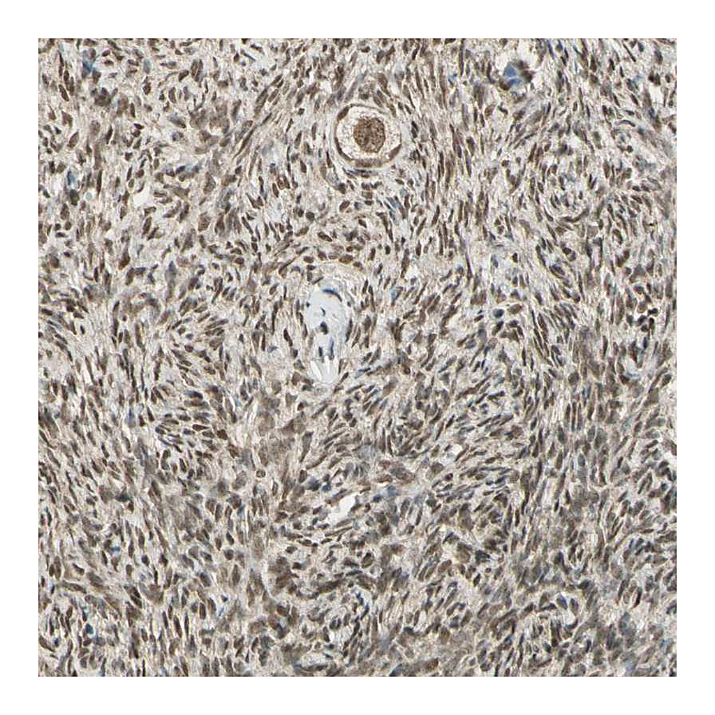 Atlas Antibodies Anti-ZNF135 Antibody