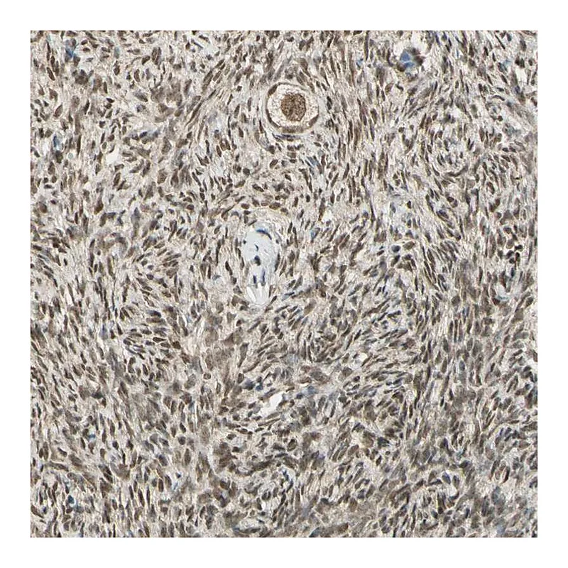 Atlas Antibodies Anti-ZNF135 Antibody