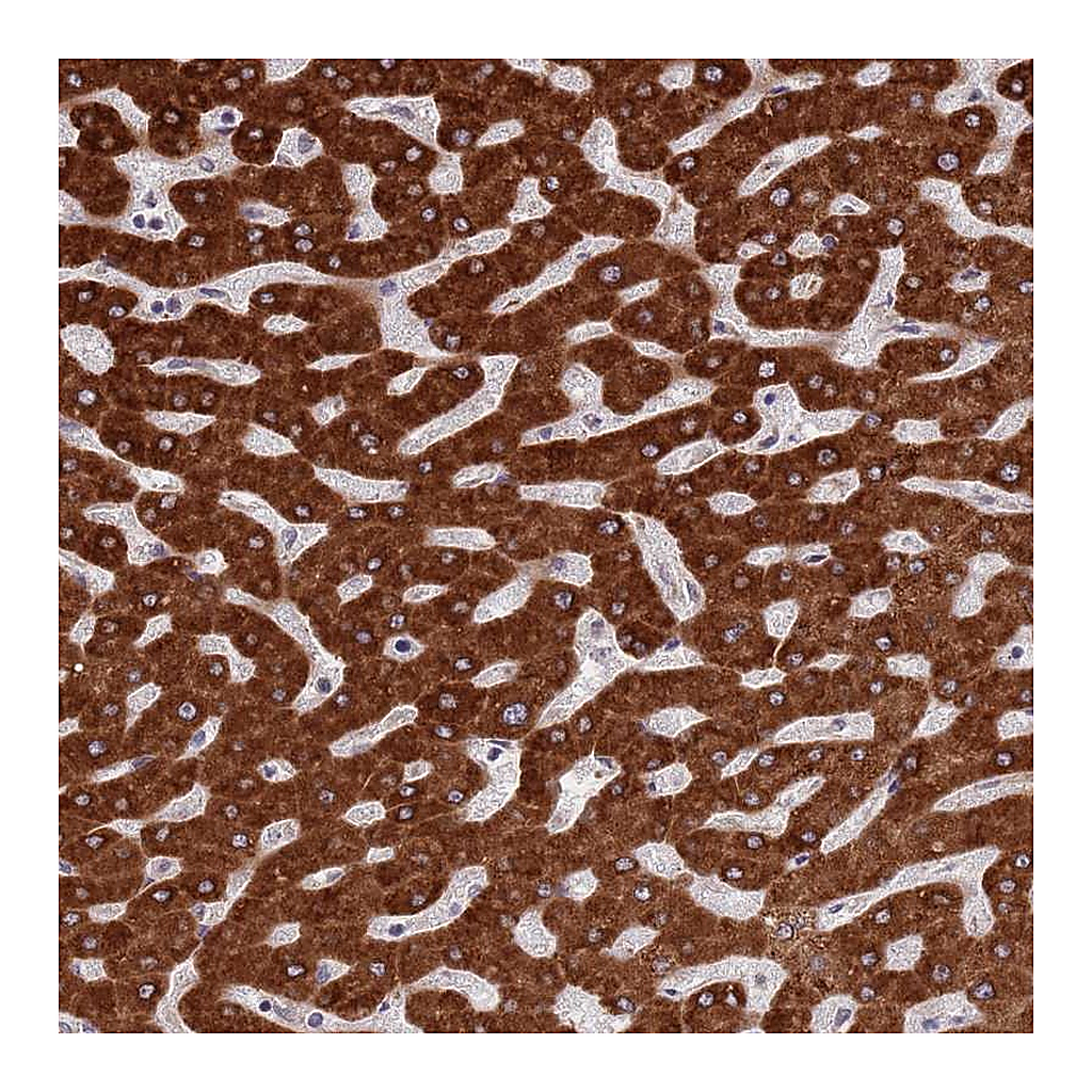 Atlas Antibodies Anti-ZNF140 Antibody
