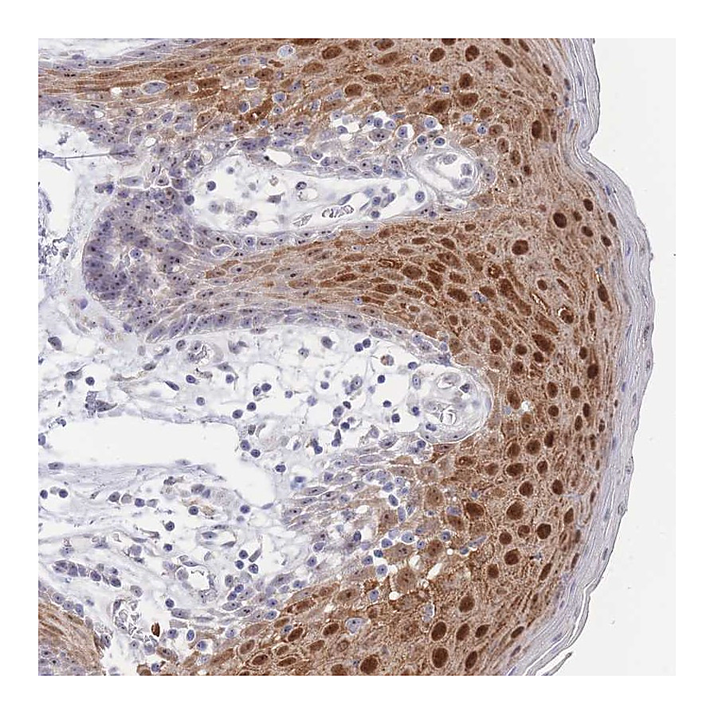 Atlas Antibodies Anti-ZNF142 Antibody