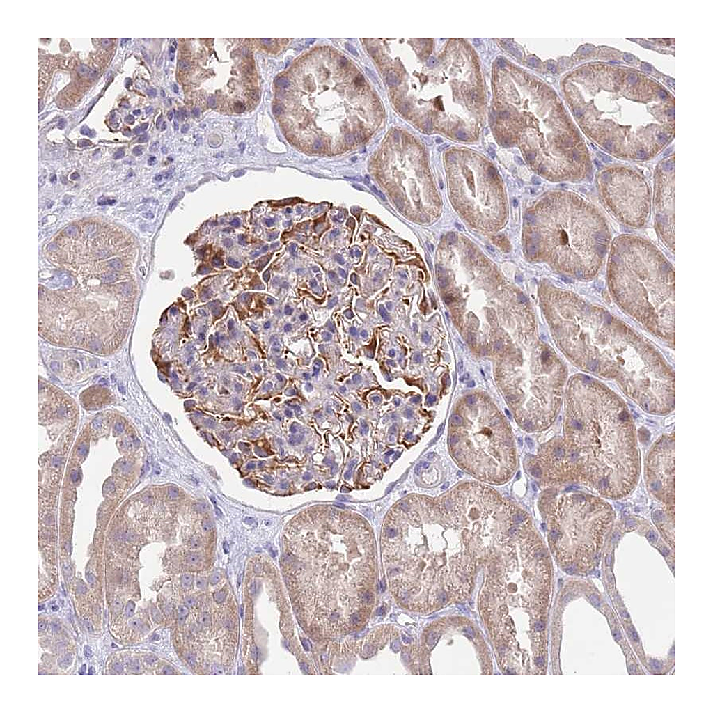 Atlas Antibodies Anti-ZNF14 Antibody