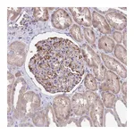 Atlas Antibodies Anti-ZNF14 Antibody