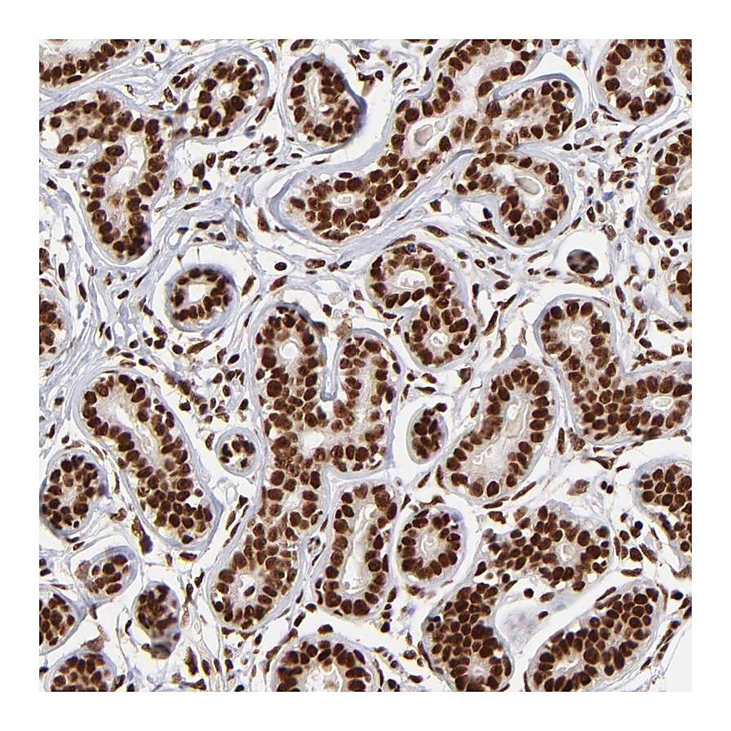 Atlas Antibodies Anti-ZNF146 Antibody