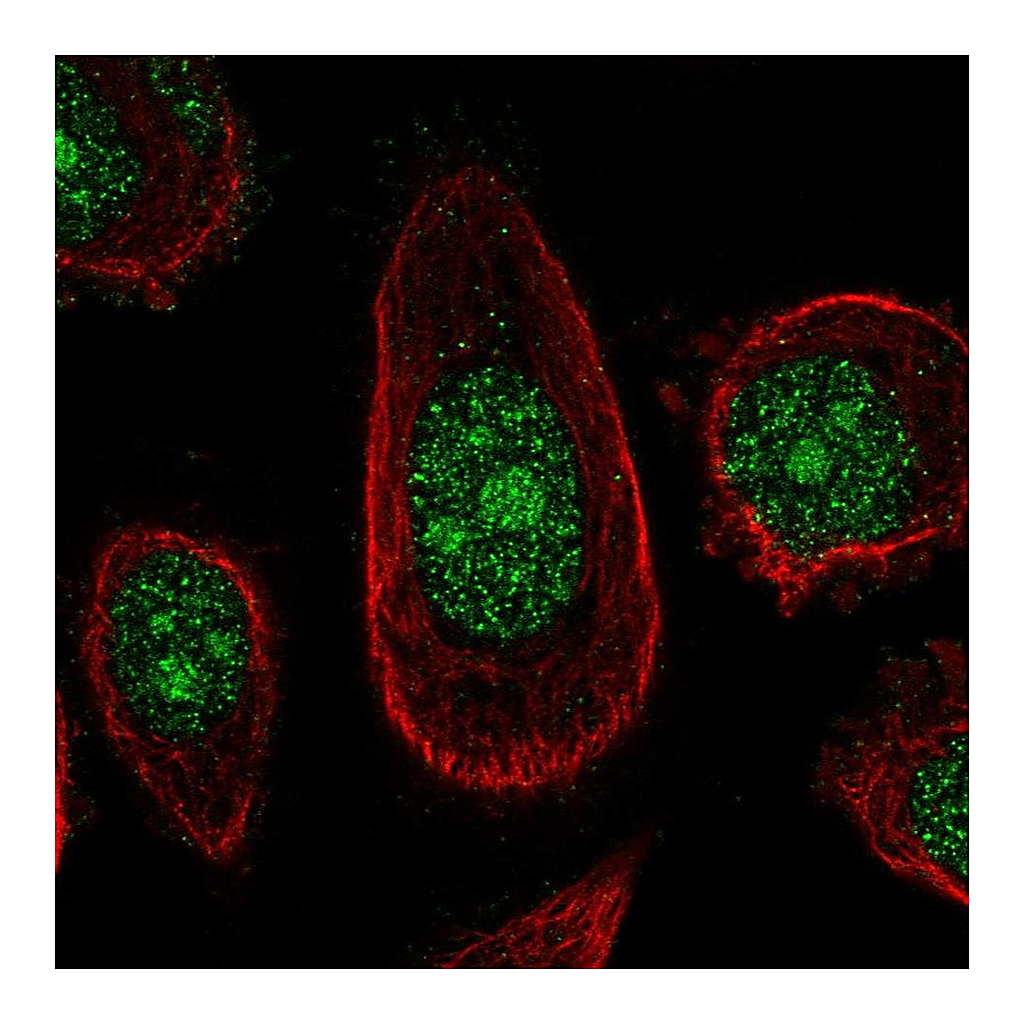 Atlas Antibodies Anti-ZNF16 Antibody