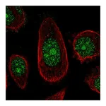 Atlas Antibodies Anti-ZNF16 Antibody