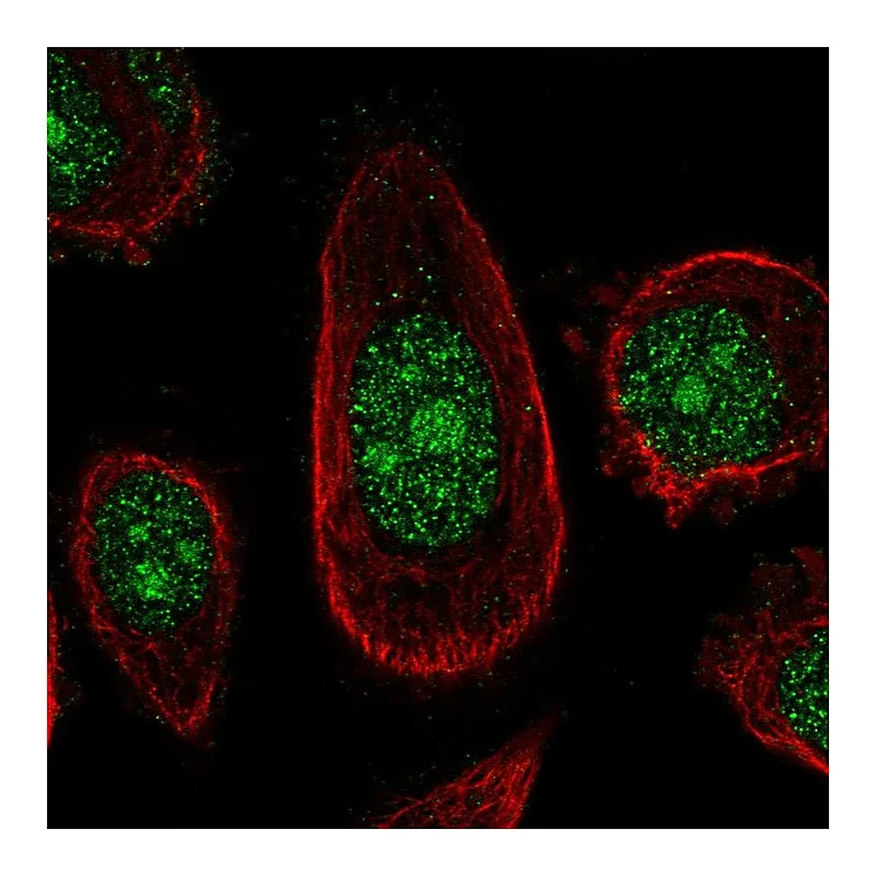 Atlas Antibodies Anti-ZNF16 Antibody