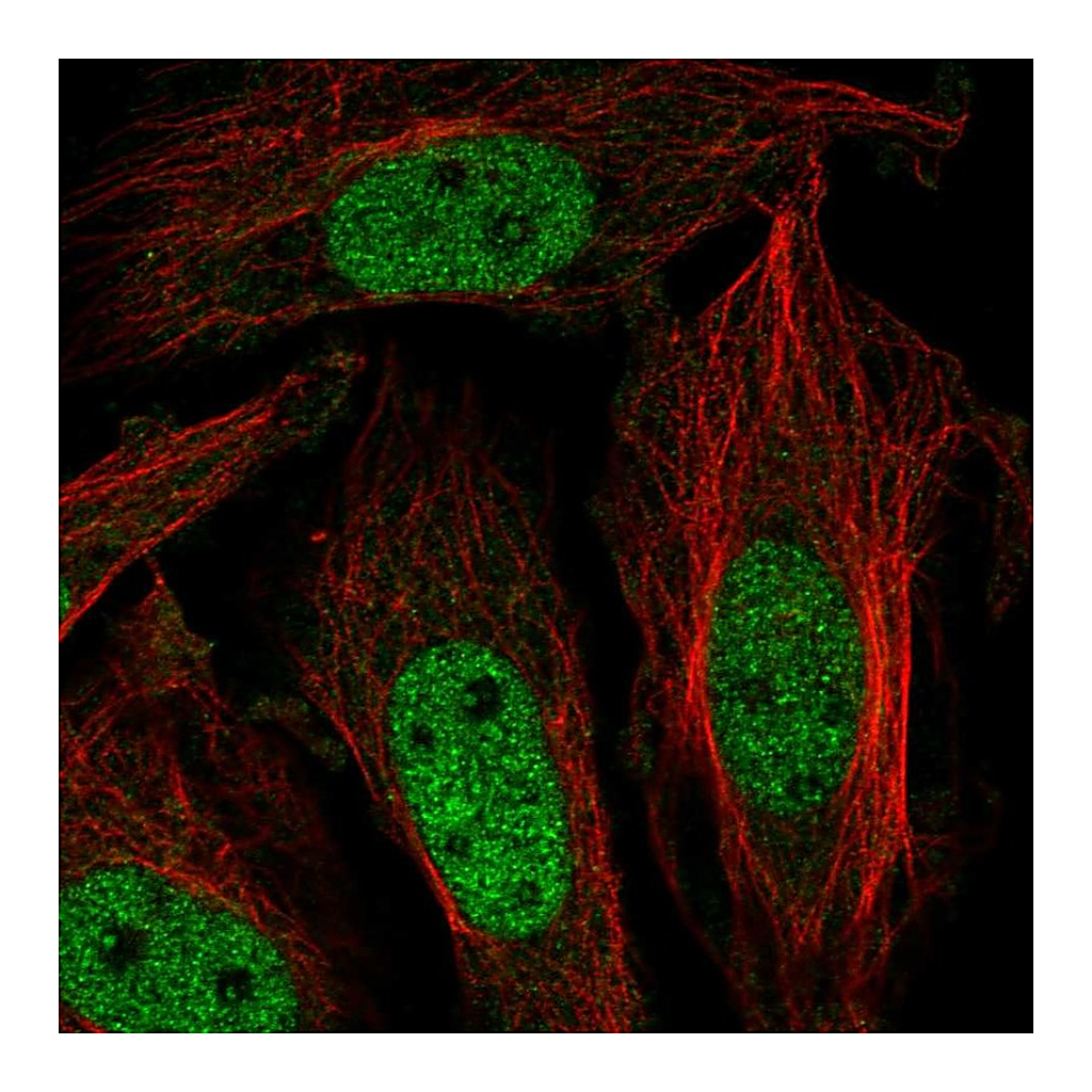 Atlas Antibodies Anti-ZNF131 Antibody