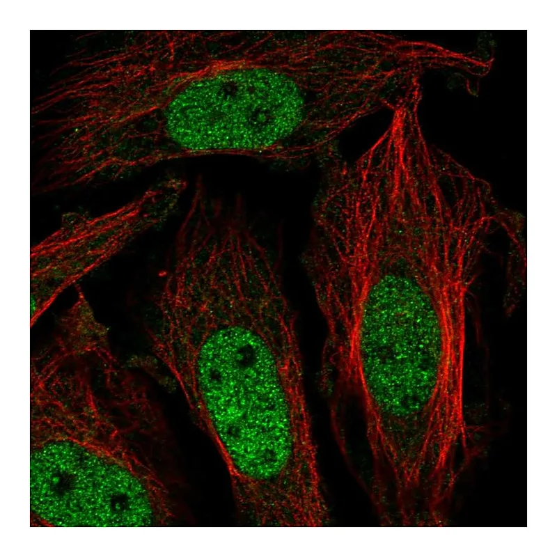 Atlas Antibodies Anti-ZNF131 Antibody