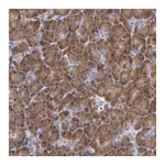 Atlas Antibodies Anti-ZNF155 Antibody